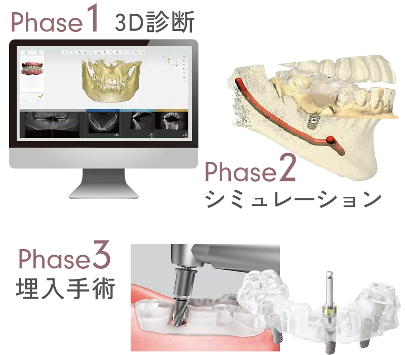 オステムワンガイド