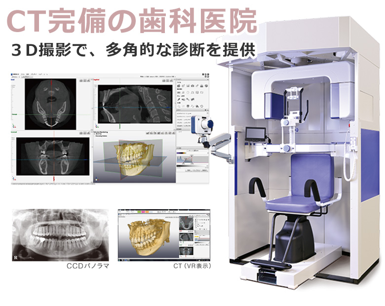 CT（3D撮影機）：NAOMI-CT（デンタル拡張タイプ）