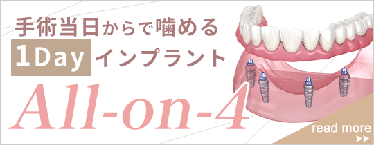 all-on-4