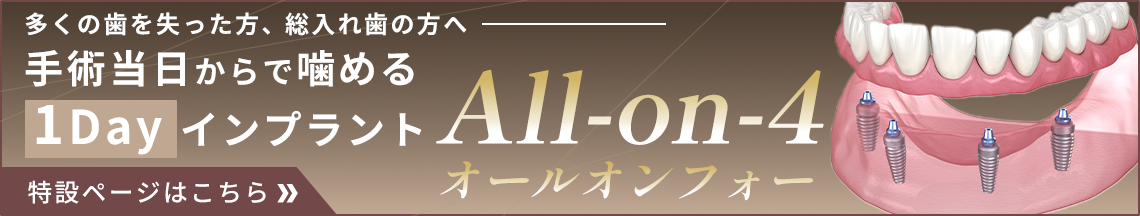 インプラント治療
