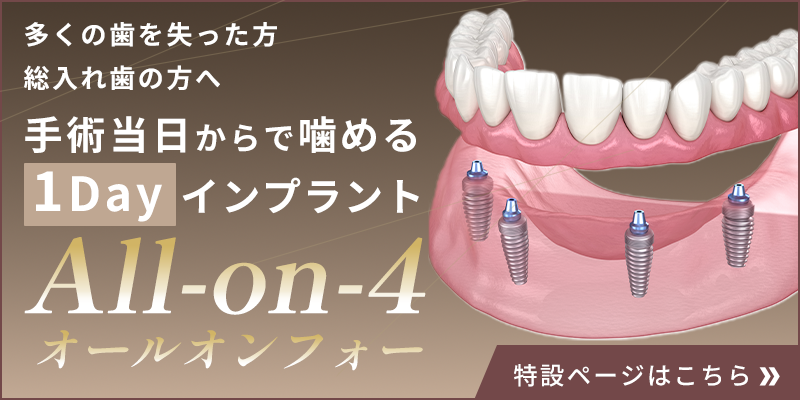 インプラント治療